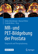 MR- und PET-Bildgebung der Prostata - 