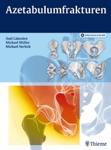 Azetabulumfrakturen - 