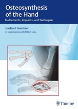 Osteosynthesis of the Hand - Hartmut F&ouml;rstner