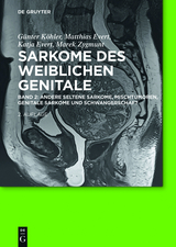 Andere seltene Sarkome,  Mischtumoren, genitale Sarkome und Schwangerschaft -  Günter Köhler
