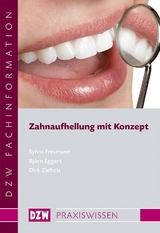 Zahnaufhellung mit Konzept
