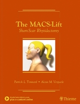 The MACS-Lift - Tonnard, Patrick; Verpaele, Alexis
