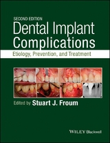 Dental Implant Complications - 