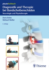 Diagnostik und Therapie bei Bandscheibensch&auml;den - 