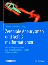Zerebrale Aneurysmen und Gef&auml;&szlig;malformationen - 