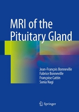 MRI of the Pituitary Gland - Jean-Fran&ccedil;ois Bonneville, Fabrice Bonneville, Fran&ccedil;oise Cattin, Sonia Nagi