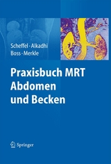 Praxisbuch MRT Abdomen und Becken -  Hans Scheffel,  Hatem Alkadhi,  Andreas Boss,  Elmar Merkle