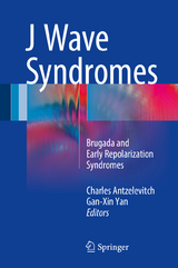 J Wave Syndromes - 