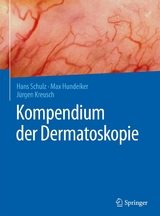 Kompendium der Dermatoskopie - Hans Schulz, Max Hundeiker, J&uuml;rgen Kreusch