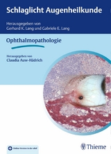 Schlaglicht Augenheilkunde: Ophthalmopathologie - 