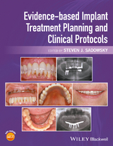 Evidence-based Implant Treatment Planning and Clinical Protocols - 