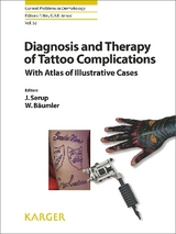 Diagnosis and Therapy of Tattoo Complications - 