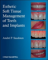 Esthetic Soft Tissue Management of Teeth and Implants - Andre P. Saadoun