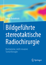 Bildgeführte stereotaktische Radiochirurgie - Harun Badakhshi