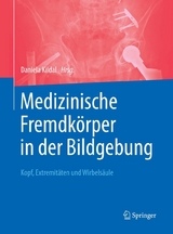 Medizinische Fremdkörper in der Bildgebung - 