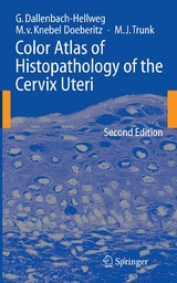 Color Atlas of Histopathology of the Cervix Uteri -  Gisela Dallenbach-Hellweg,  Magnus Knebel Doeberitz,  Marcus J. Trunk