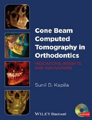 Cone Beam Computed Tomography in Orthodontics
