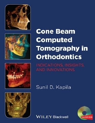 Cone Beam Computed Tomography in Orthodontics - Sunil Kapila