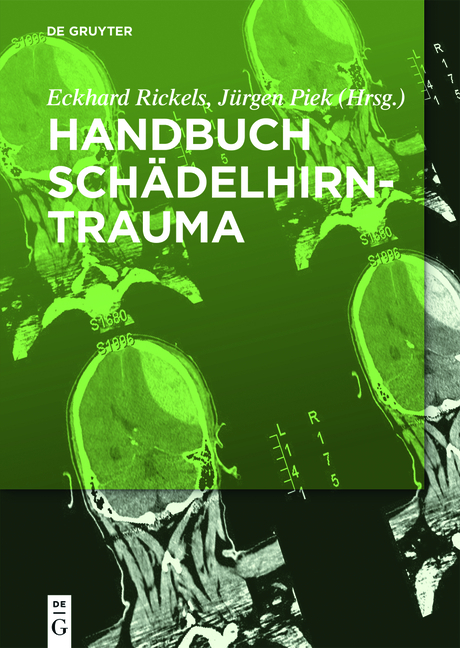 Handbuch Sch&auml;del-Hirn-Trauma - 