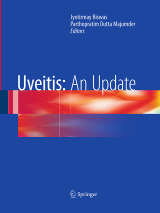 Uveitis: An Update