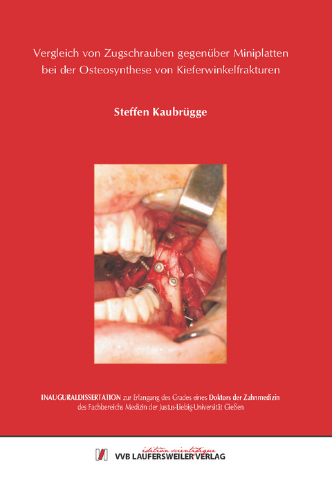 Vergleich von Zugschrauben gegen&uuml;ber Miniplatten bei der Osteosynthese von Kieferwinkelfrakturen - Steffen Kaubr&uuml;gge
