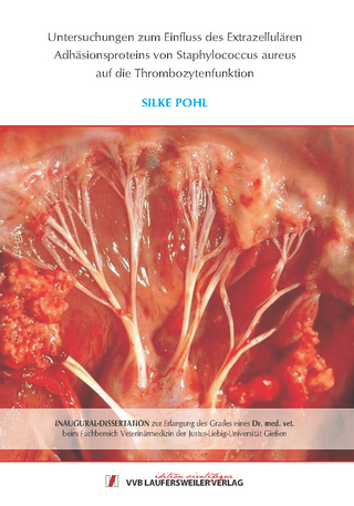 Untersuchungen zum Einfluss des Extrazellulären Adhäsionsproteins von Staphylococcus aureus auf die Thrombozytenfunktion