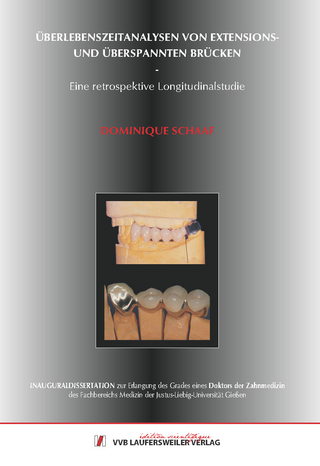 Überlebenszeitanalysen von Extensions- und über-spannten Brücken - Eine retrospektive Longitudinalstudie