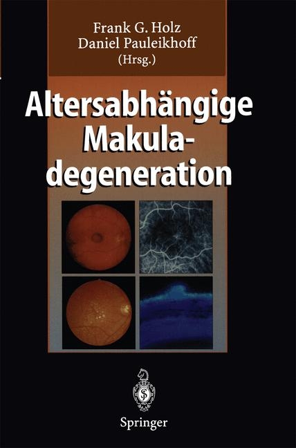 Altersabh&auml;ngige Makuladegeneration - 