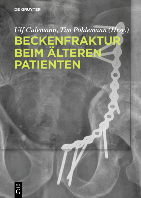 Beckenfraktur beim &auml;lteren Patienten - 