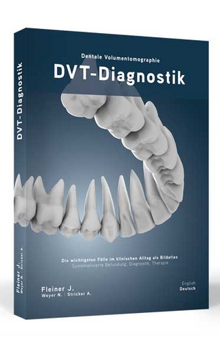 DVT-Diagnostik