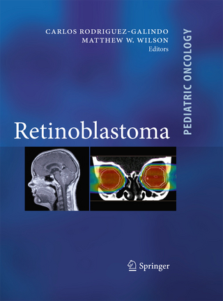 Retinoblastoma