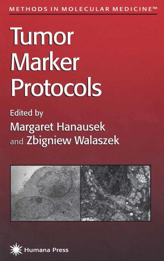 Tumor Marker Protocols