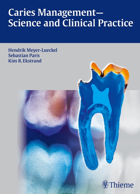 Caries Management - Science and Clinical Practice - Hendrik Meyer-L&uuml;ckel, Sebastian Paris, Kim Ekstrand