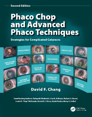 Phaco Chop and Advanced Phaco Techniques - David F. Chang