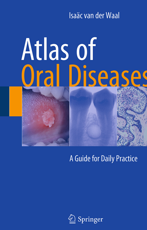 Atlas of Oral Diseases - Isa&auml;c van der Waal