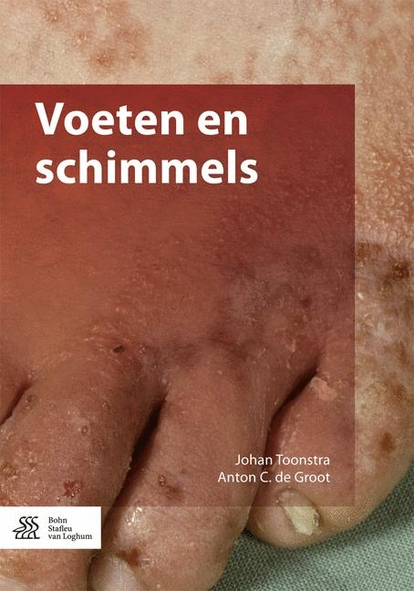 Voeten En Schimmels - Johan Toonstra, A C De Groot