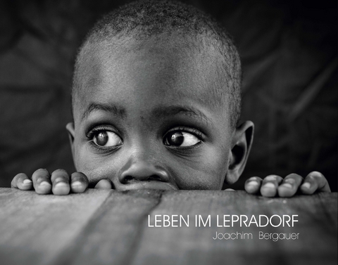 Leben im Lepradorf - Joachim Bergauer