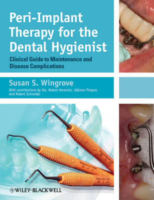 Peri-Implant Therapy for the Dental Hygienist - Clinical Guide to Maintenance and Disease Complications - SS Wingrove