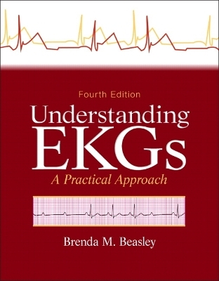 Understanding EKGs