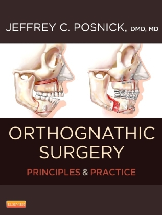 Orthognathic Surgery - 2 Volume Set