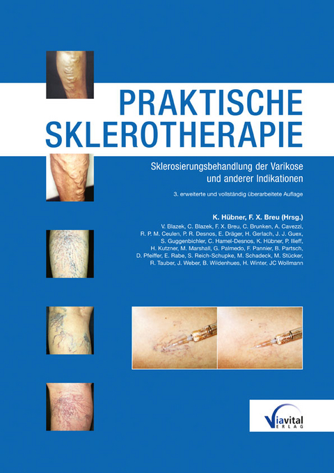 Praktische Sklerotherapie - 