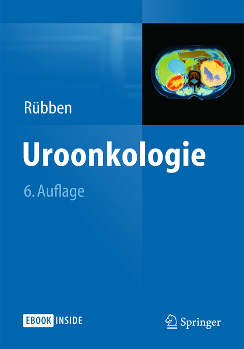 Uroonkologie - 