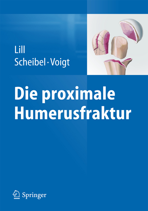 Die proximale Humerusfraktur - 