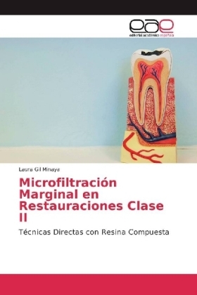 Microfiltración Marginal en Restauraciones Clase II