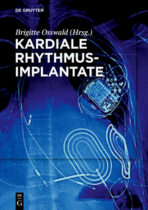 Kardiale Rhythmusimplantate - 