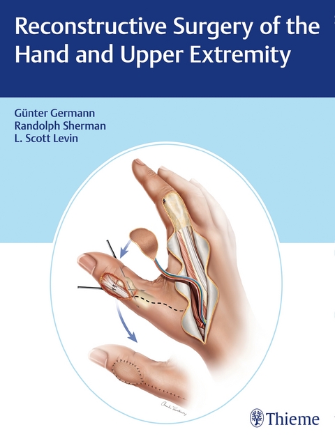 Reconstructive Surgery of the Hand and Upper Extremity - Gunter Germann, L.Scott Levin, Randolph Sherman
