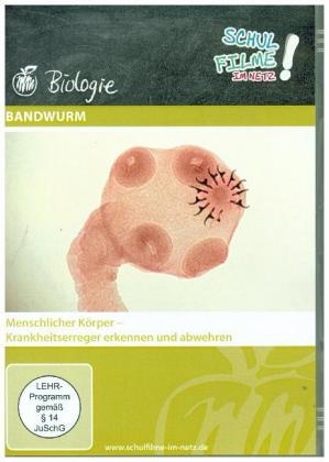 Bandwurm, 1 DVD