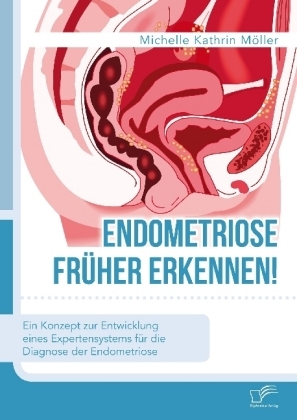 Endometriose fr&uuml;her erkennen! Ein Konzept zur Entwicklung eines Expertensystems f&uuml;r die Diagnose der Endometriose - Michelle Kathrin M&ouml;ller
