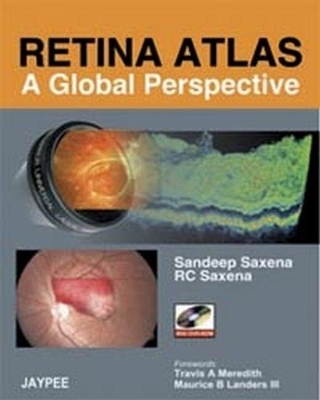 Retina Atlas - A Global Perspective - Sandeep Saxena, RC Saxena