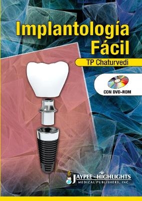 Implantolog&iacute;a F&aacute;cil - TP Chaturvedi